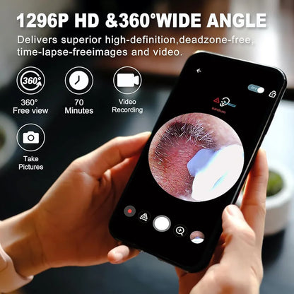 Smart™ Visual Ear Wax Cleaner